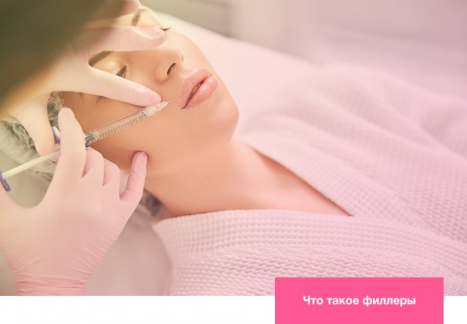 Что такое филлеры